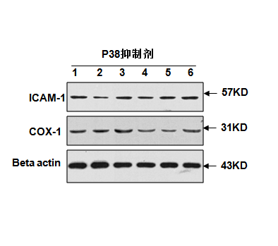 Western blot ӡEWB